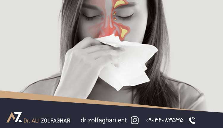 سینوزیت قارچی چیست 
