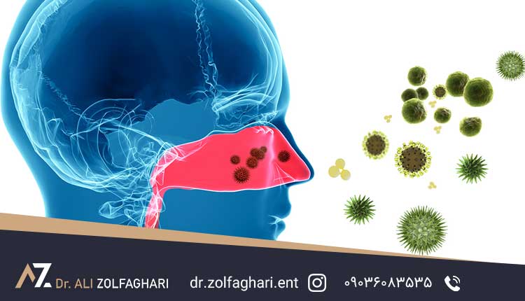 نشانه های سینوزیت قارچی
