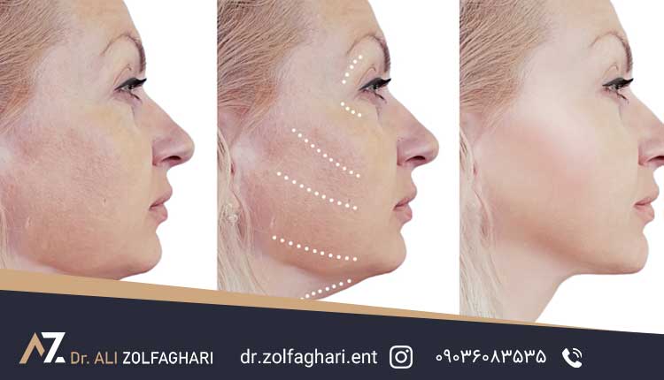 انتخاب بهترین گزینه با توجه اهداف خود