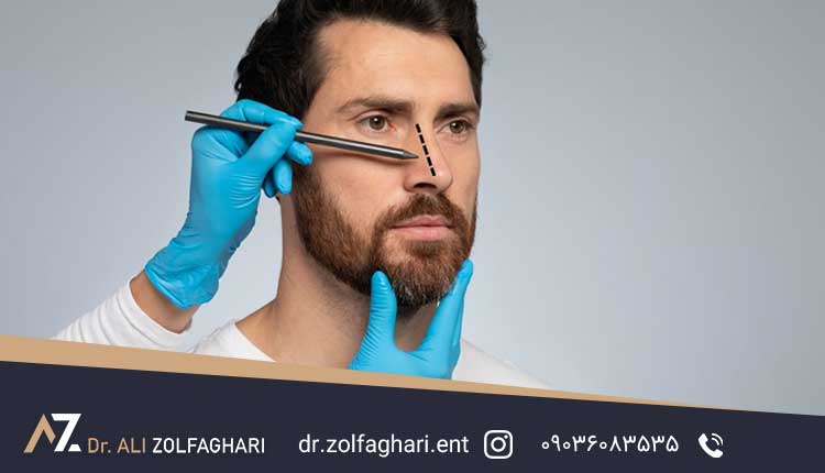 هزینه درمان بینی زینی شکل چقدر است؟
