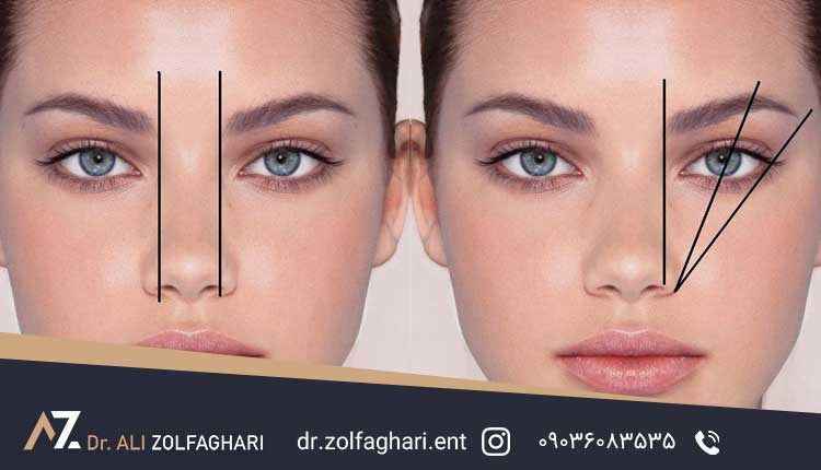 تقارن صورت
