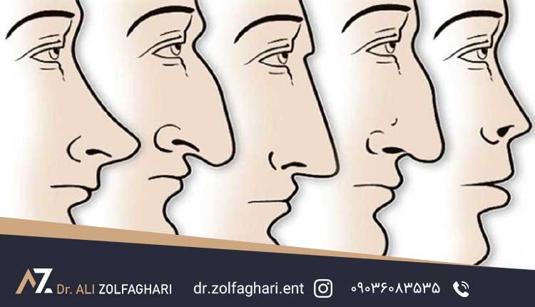 بینی مناسب برای فرم صورت شما