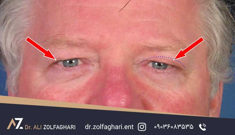 بررسی دقیق قبل از جراحی