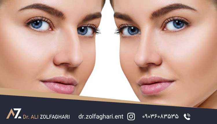 اصلاح نقایص مادرزادی یا آسیب های ناشی از تروما