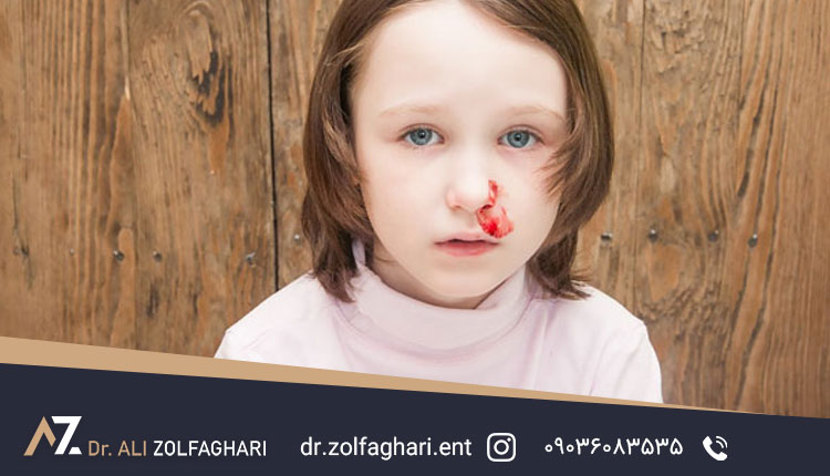 راههای جلوگیری از عوارض شکستگی بینی در کودکان
