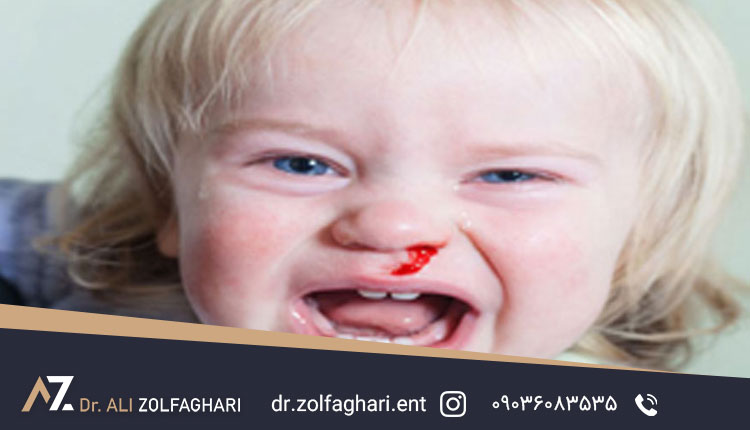 بینی شکسته کودک را عمل نکنیم چه میشود؟