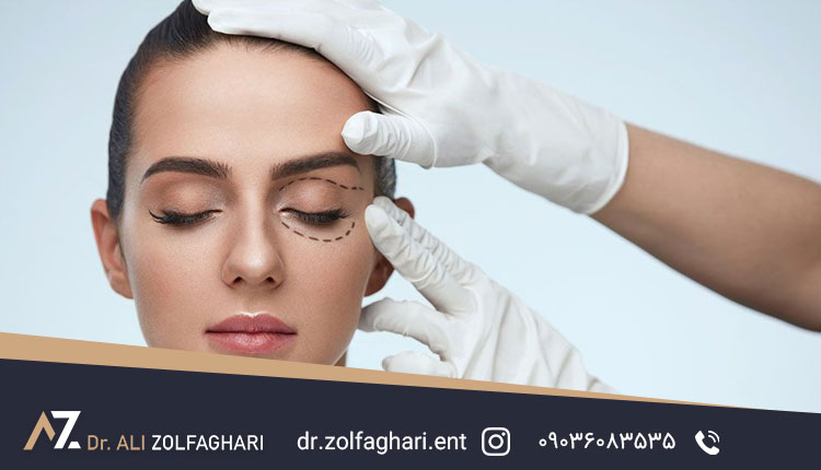 ماساژ چشم بعد از عمل بلفاروپلاستی