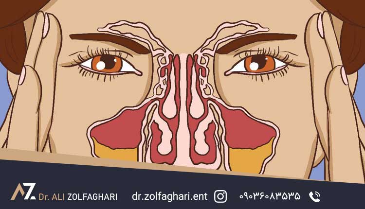 مشکلات تنفسی مانند تنفس از دهان و گرفتگی شدید بینی
