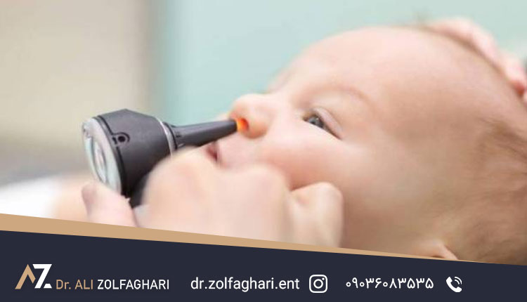 پولیپ بینی در کودکان علائم و راه های درمان