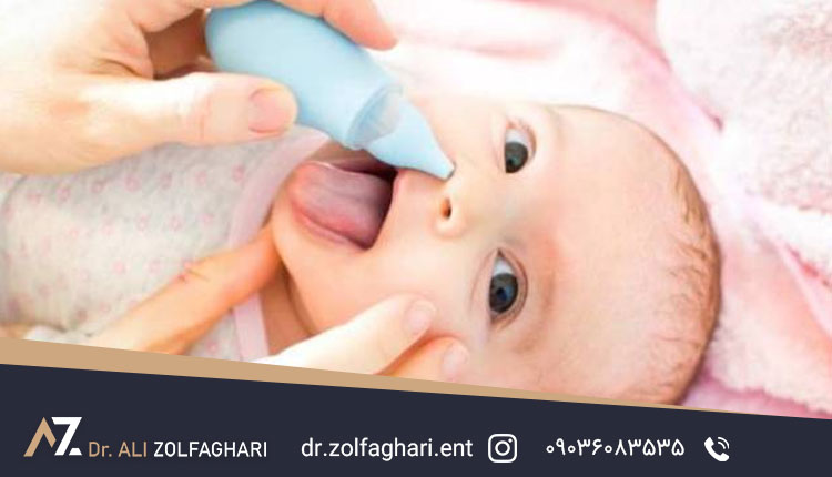 علل ایجاد پولیپ بینی در کودکان