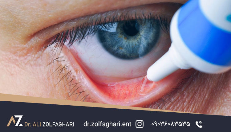 راههای جلوگیری از کوچک شدن چشم بعد از بلفاروپلاستی