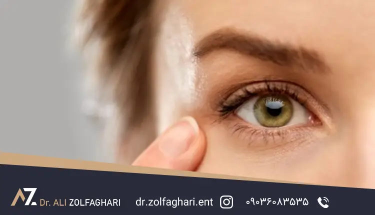 ژل ترمیم‌کننده بعد از عمل پلک لافاسیل لافارر