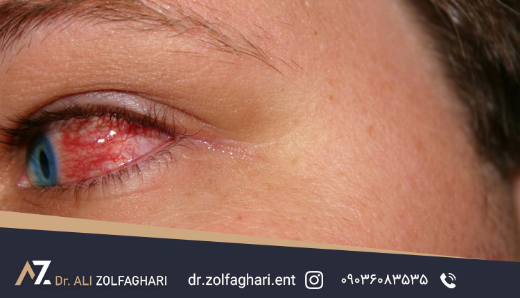 آیا نیاز به مراجعه به پزشک هست؟