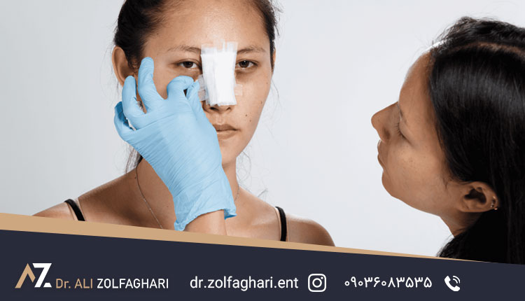 برای رفع کبودی بعد از عمل بینی چه بخوریم؟
