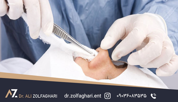 مراقبت های بعد از کشیدن تامپون بینی
