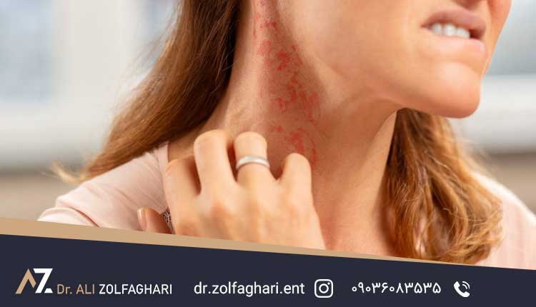 عوارض مصرف قرص پردنیزولون بعد از عمل بینی