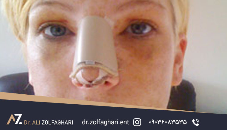 تورم پوست