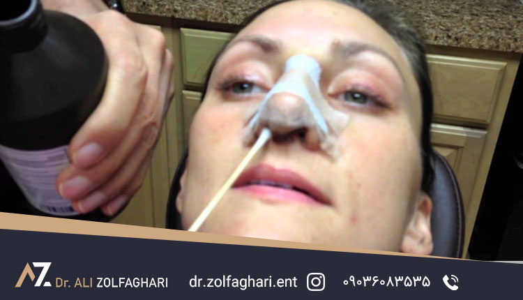 اهمیت ورم بینی