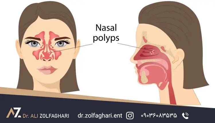 اجزای بینی
