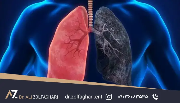 مشکلات تنفسی