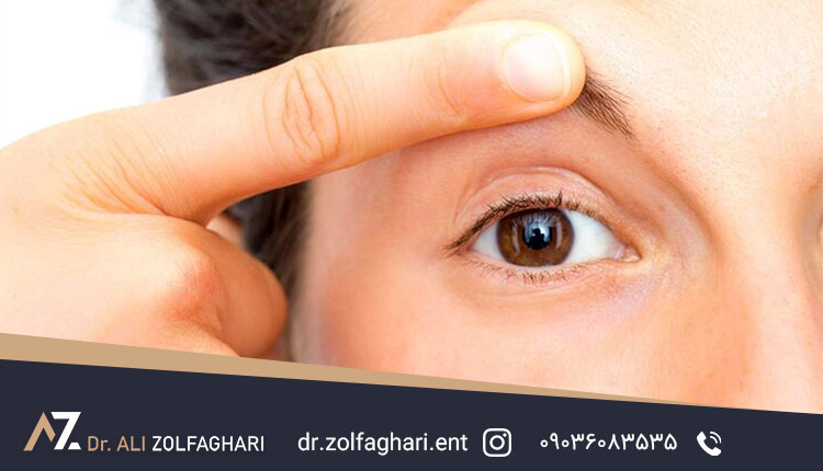بهترین راه درمان افتادگی پلک