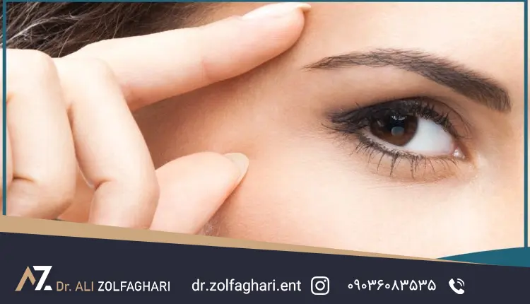 سیزده راه درمان افتادگی پلک با ورزش