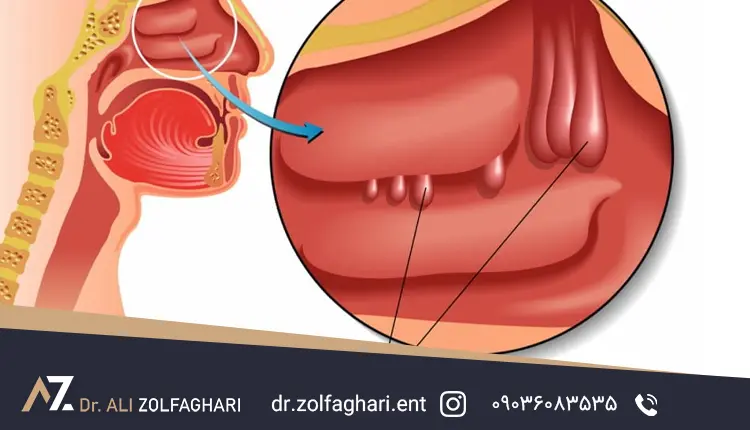 عوارض عمل