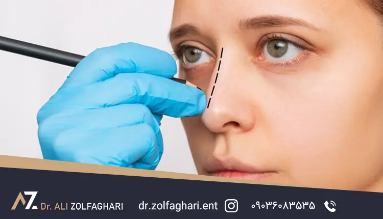 عمل زیبایی بینی یا رینوپلاستی
