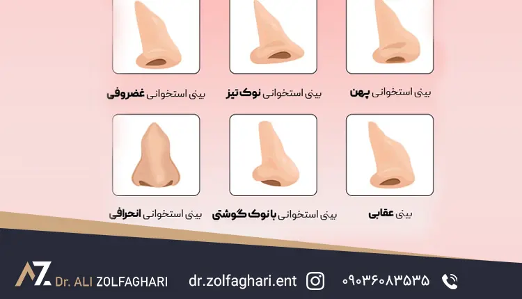 انواع بینی استخوانی