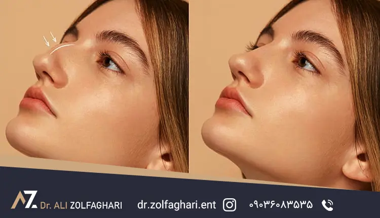 چسب نامرئی