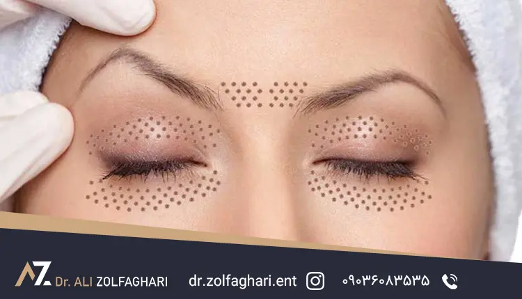 پلاسما جت