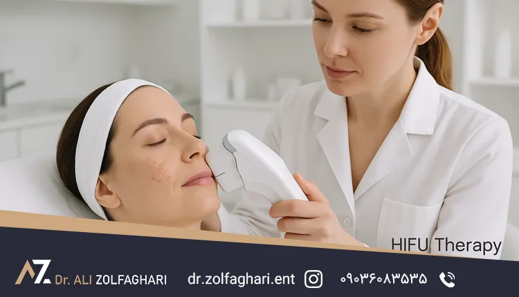 هایفوتراپی برای لک صورت
