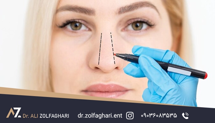 انواع روش های عمل رینوپلاستی