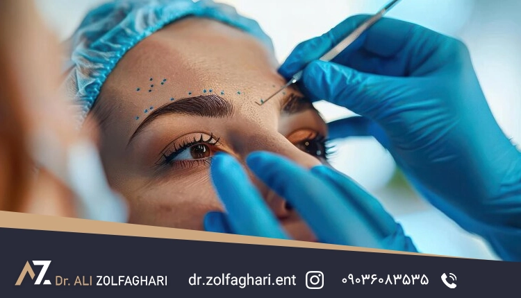 مقایسه هزینه عمل پلک بالا و پایین