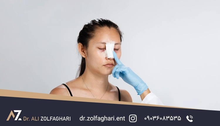 مراقبت‌های بعد از رینوپلاستی | نکاتی که نباید فراموش کنید