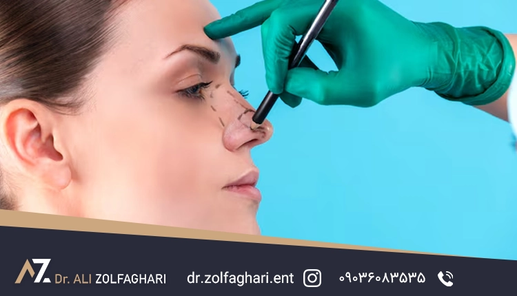 جراحی رینوپلاستی به روش بسته چه مزایایی دارد؟