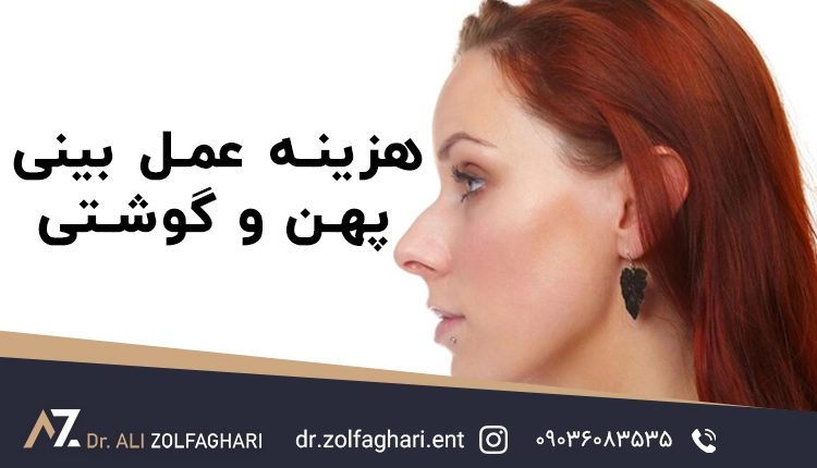 بررسی کامل هزینه جراحی رینوپلاستی