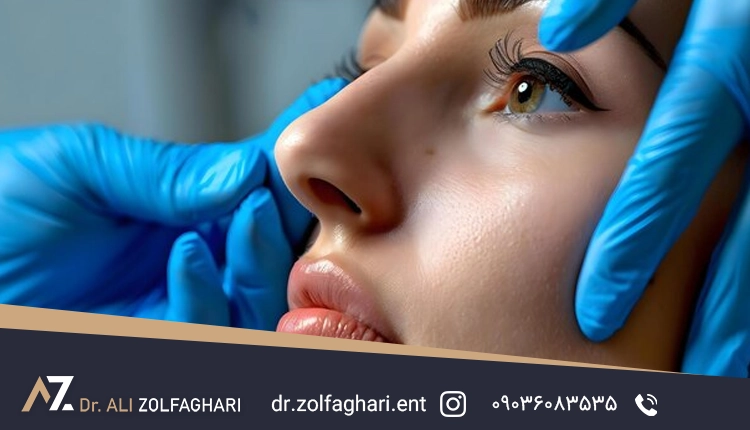 جراحی رینوپلاستی