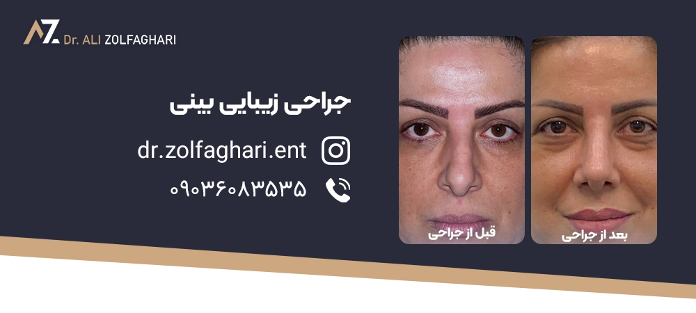 تجربه مریم، 25 ساله
