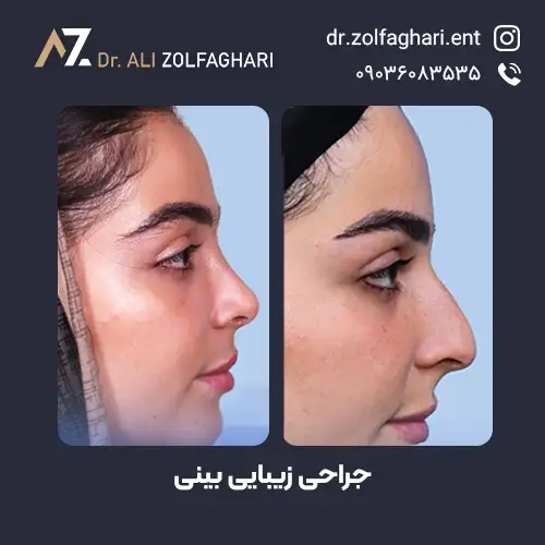 نمونه کار‌های دکتر علی اصغر ذوالقاری