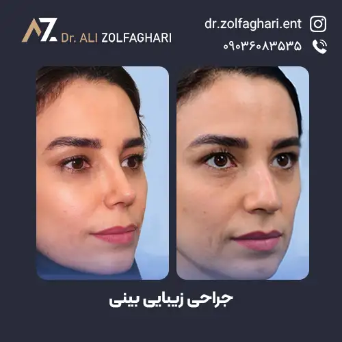 نمونه کار‌های دکتر علی اصغر ذوالقاری
