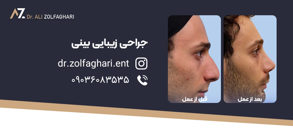 جراحی بینی در بیماران قلبی
