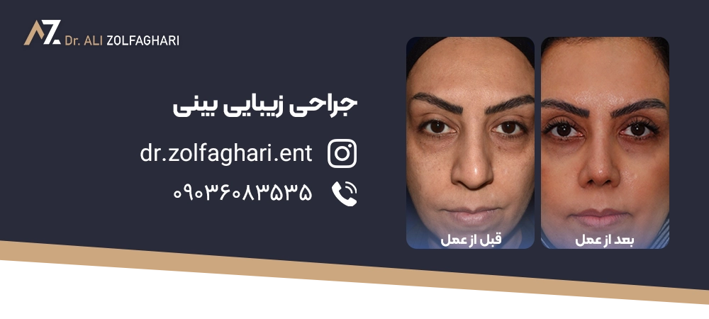 قبل از جراحی چه سوالاتی از جراح بینی باید بپرسم؟