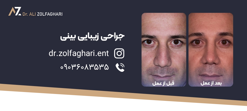 آیا عمل جراحی رینوپلاستی خطرناک است؟