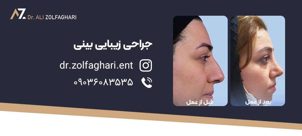 بعد از عمل