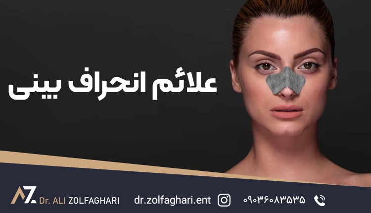 علائم انحراف بینی