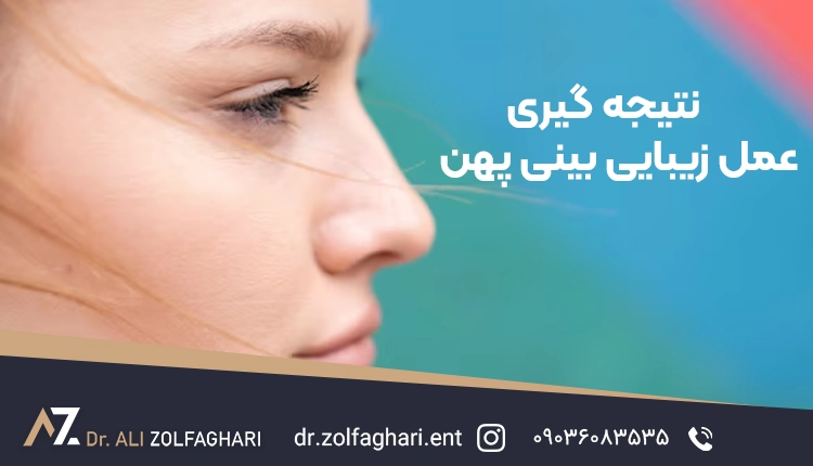 نتیجه گیری عمل زیبایی بینی پهن