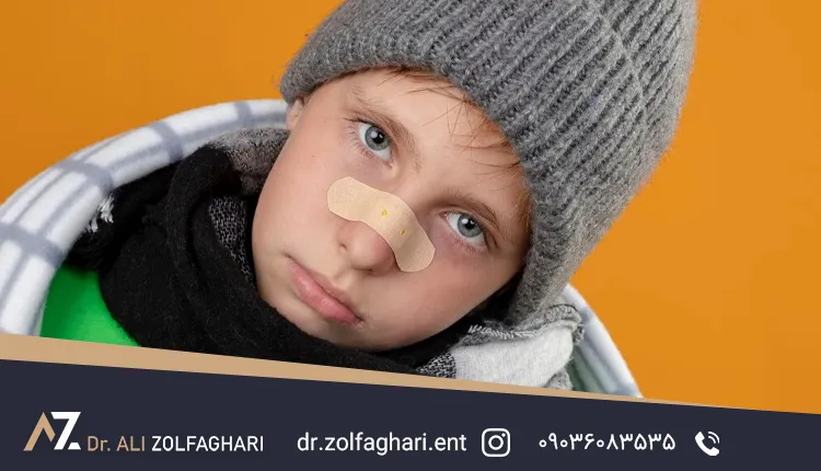 شکستگی بینی کودکان