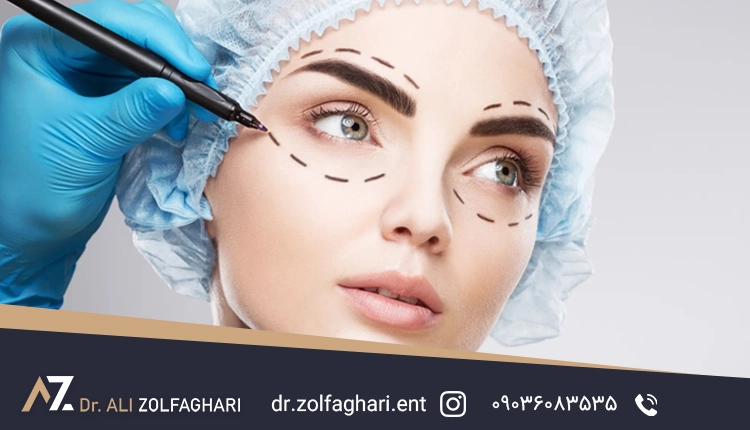 بلفاروپلاستی چیست