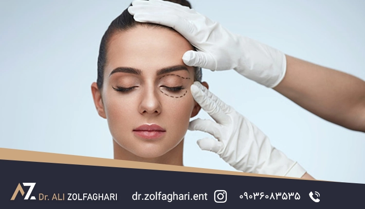 جراحی پلک بالایی چشم